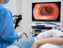 Endoscopía